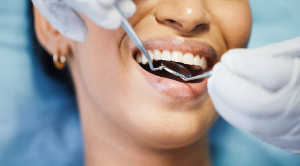 Best Pediatric Emergency Dentist in Canton, SD