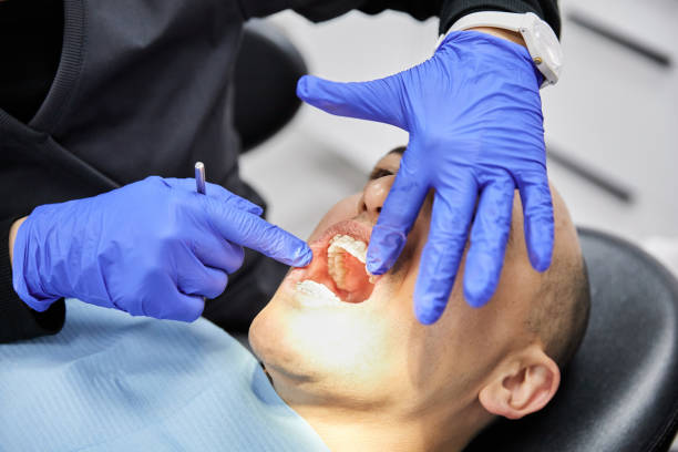 Best Emergency Broken Tooth Repair in Canton, SD